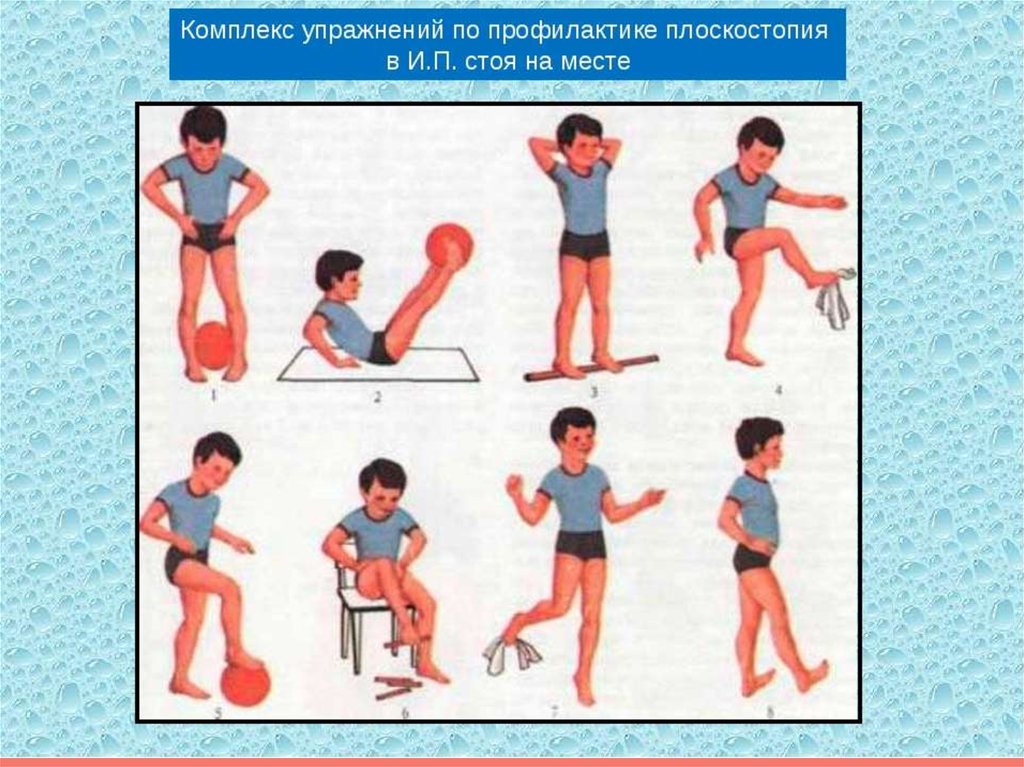 Картинки с упражнениями для детей. Комплекс гимнастики для профилактики плоскостопия. Комплекс упражнений для профилактики плоскостопия. Комплекс упражнений для профилактики плоскостопия у детей. Комплекс физических упражнений для профилактики плоскостопия.