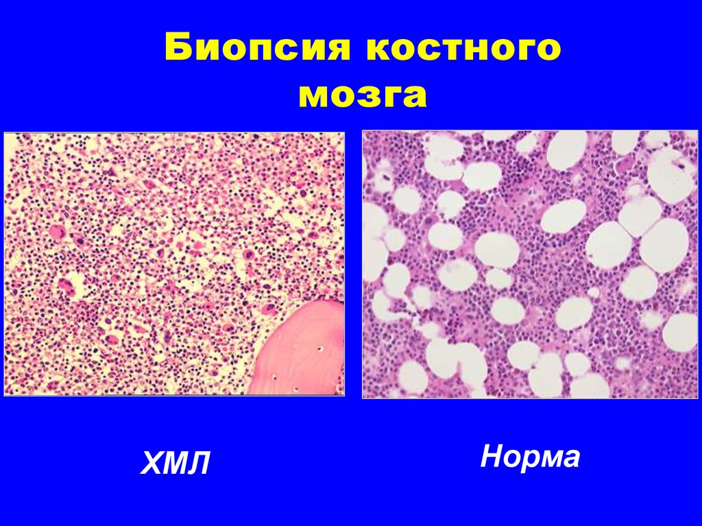 Где купить костные мозги. Кристаллы костного мозга Геншин. Костный мозг в норме гистология. Красный костный мозг гистология.