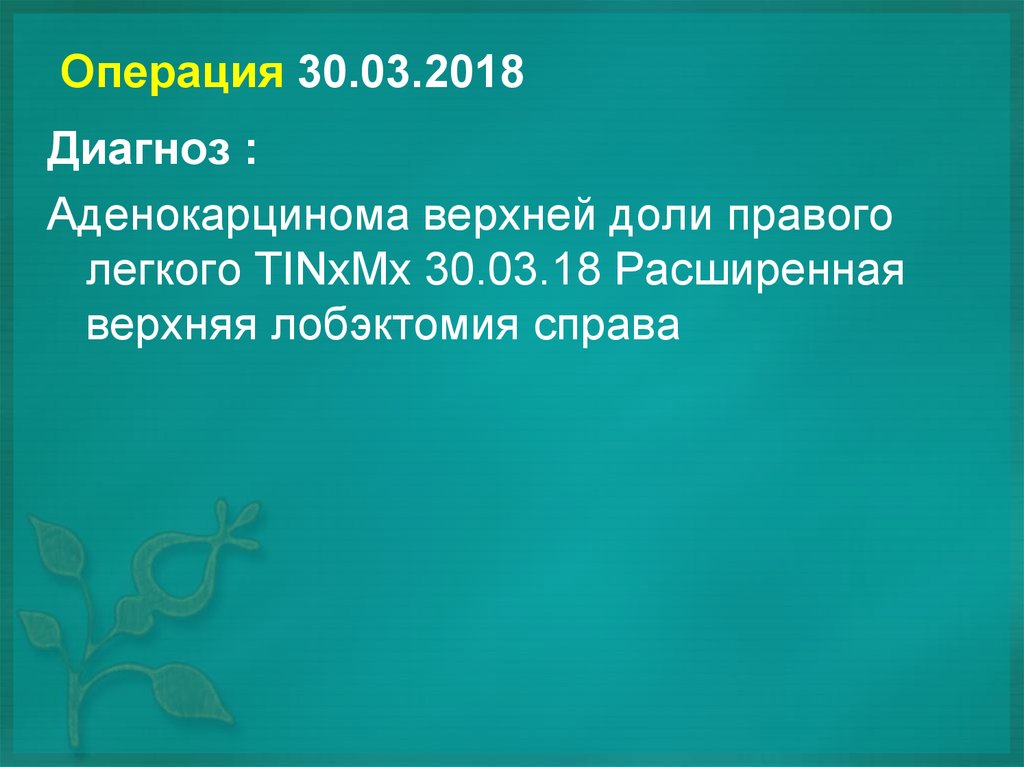 Операция 30.03.2018