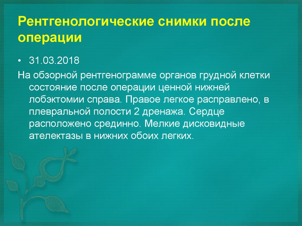Рентгенологические снимки после операции