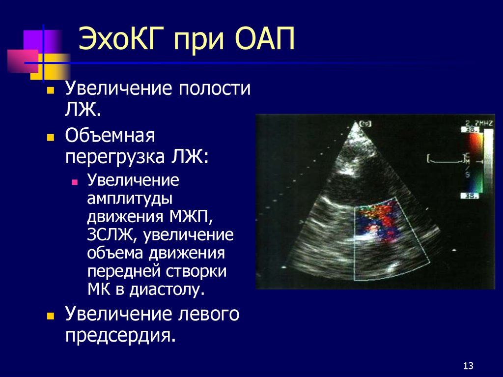 Эхокардиография сердца презентация