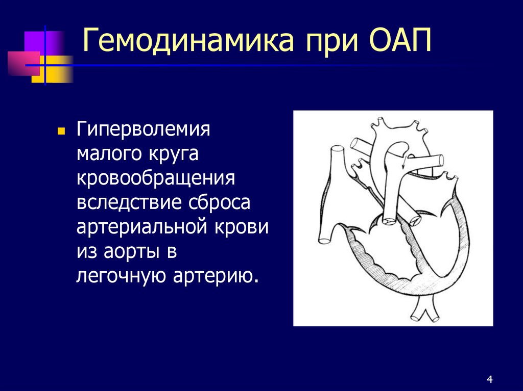 Схема открытого артериального протока