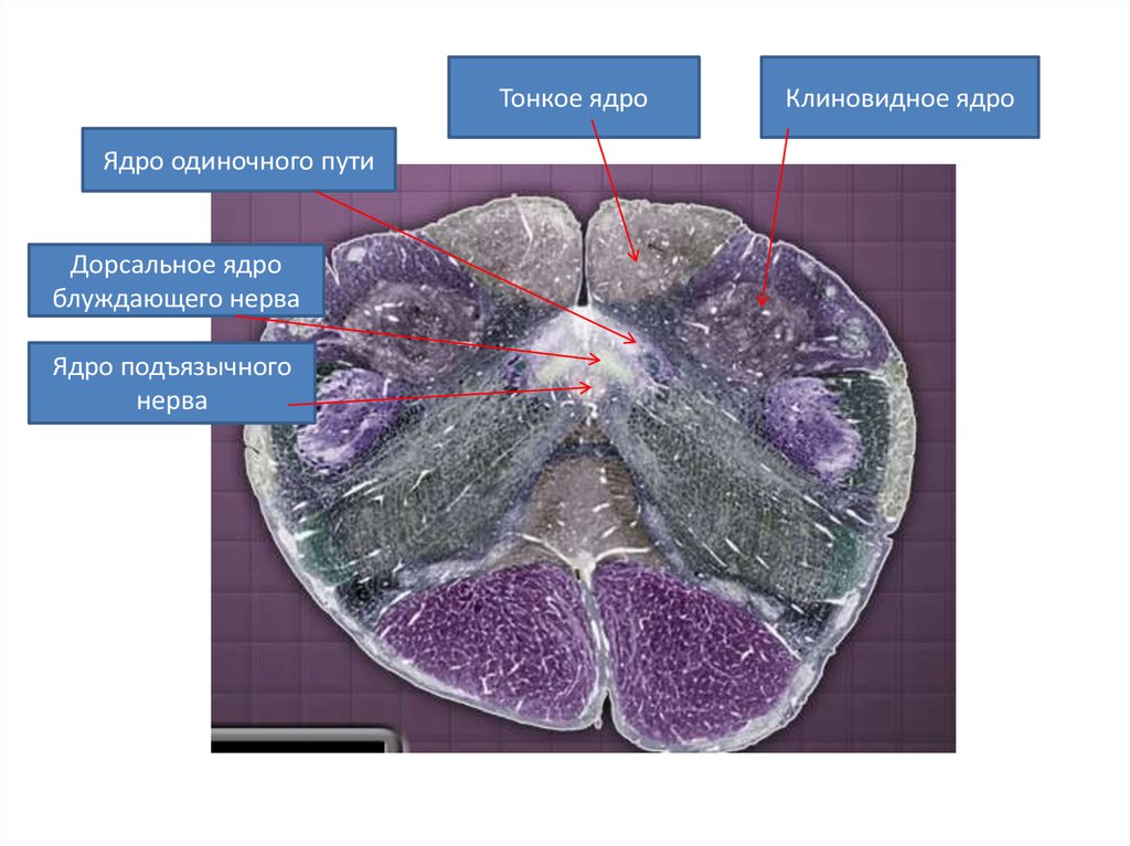Ядра продолговатого мозга. Клиновидное ядра продолговатого мозга. Тонкое и клиновидное ядра продолговатого мозга. Ядро одиночного пути. Дорсальное ядро блуждающего нерва.