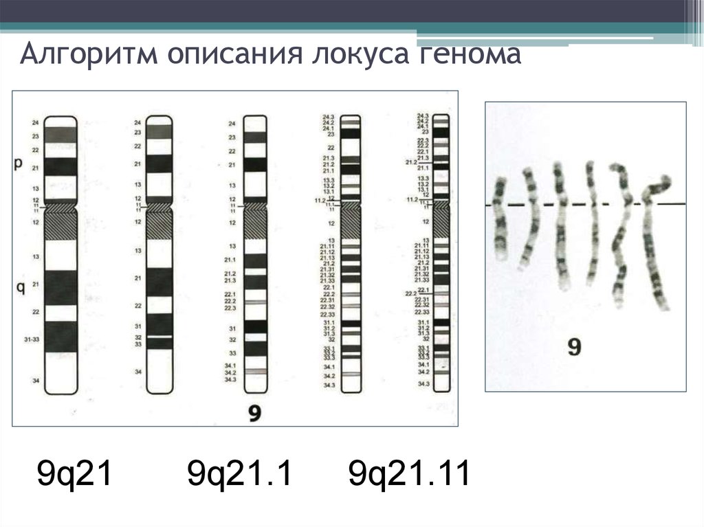 Сайт локуса. Ген хромосома Локус. Строение хромосомы Локус. Локус ДНК. Локусы хромосом.