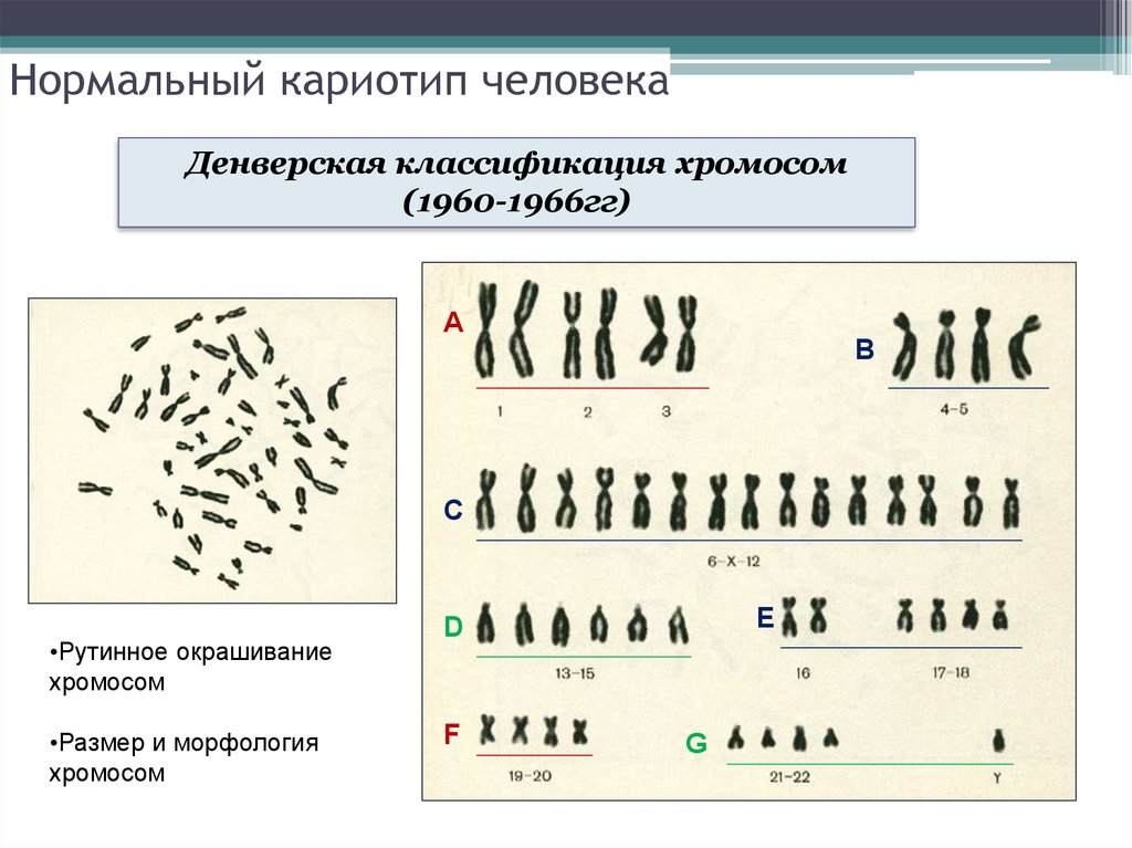 Хромосом группы d. Кариотип классификация хромосом. Кариотип человека Денверская классификация хромосом. Кариотип человека классификация хромосом человека. Клетка печени кариотип.