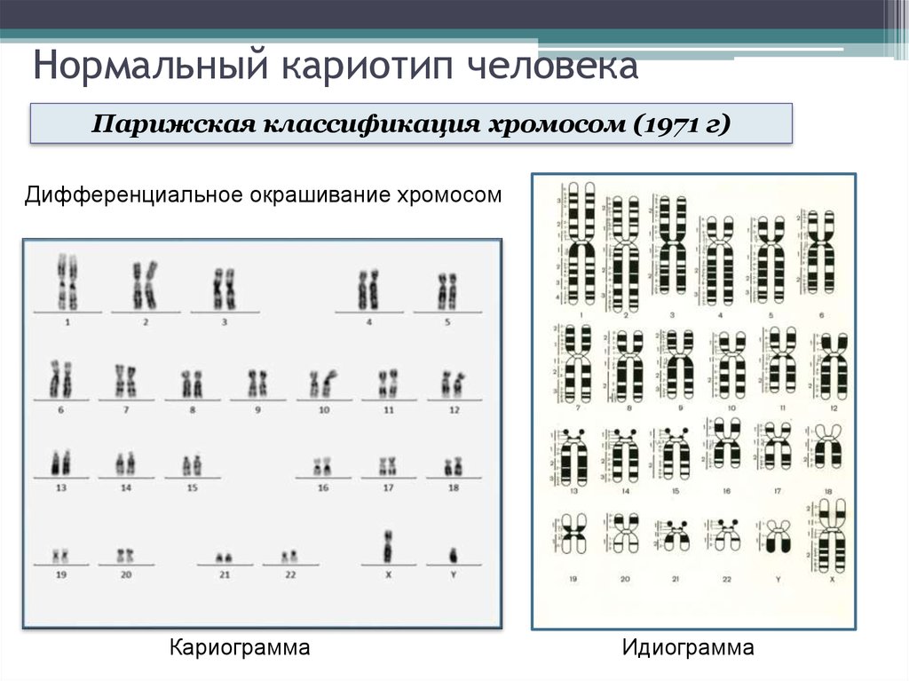 Количество хромосом в кариотипе человека. Кариотип набор хромосом 2n2c. Хромосомная карта кариотип. Идиограмма кариотипа человека. Нормальный кариотип человека 46 хромосом.