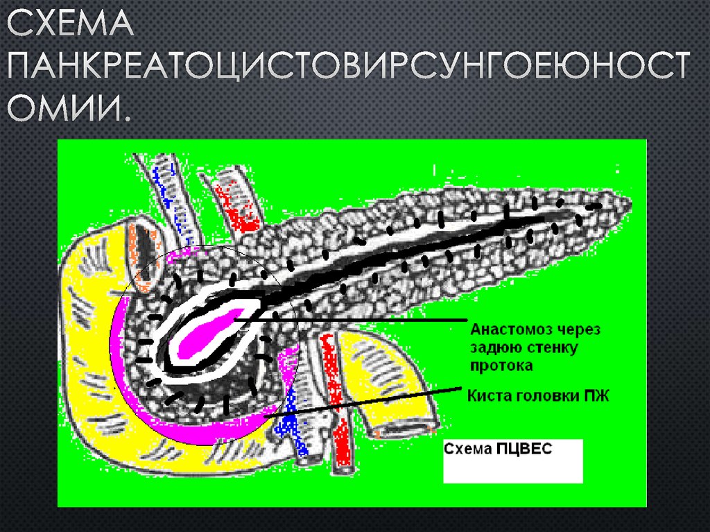 Стенки протока