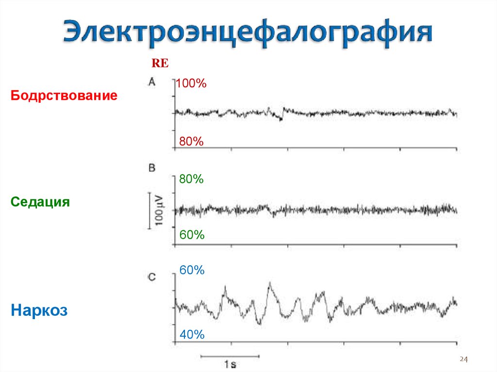 Учебный план электроэнцефалография