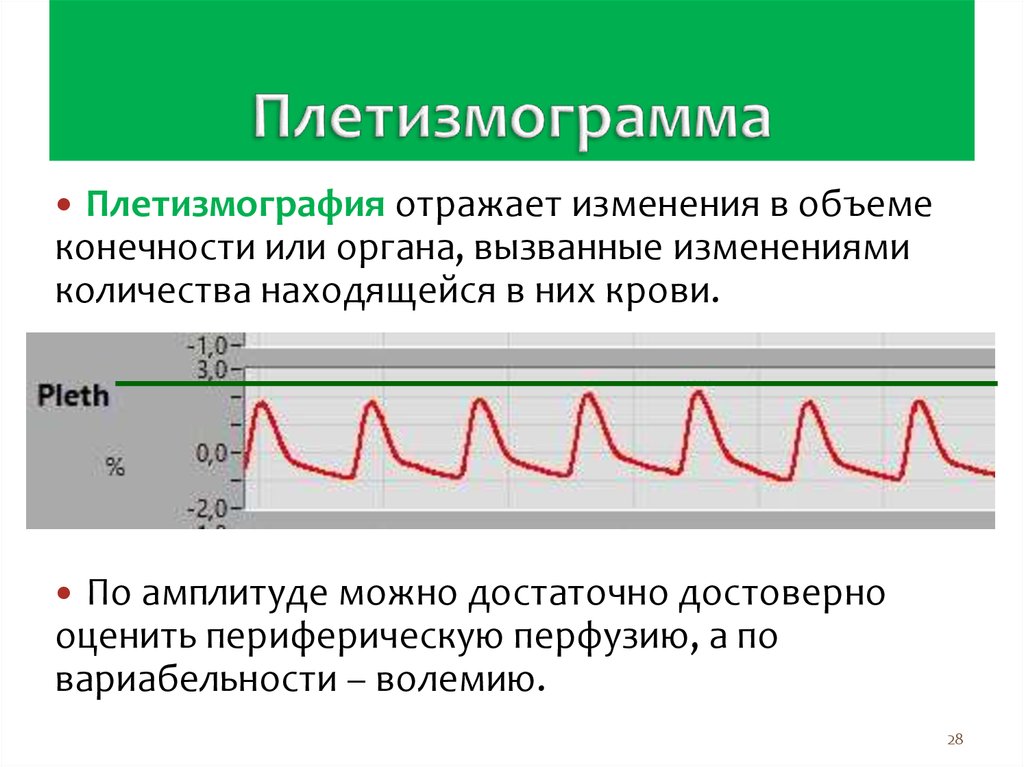 Отразить изменения. Плетизмограмма. Плетизмограмма пульсовая волна. Плетизмография Пульсоксиметр. Плетизмограмма график.