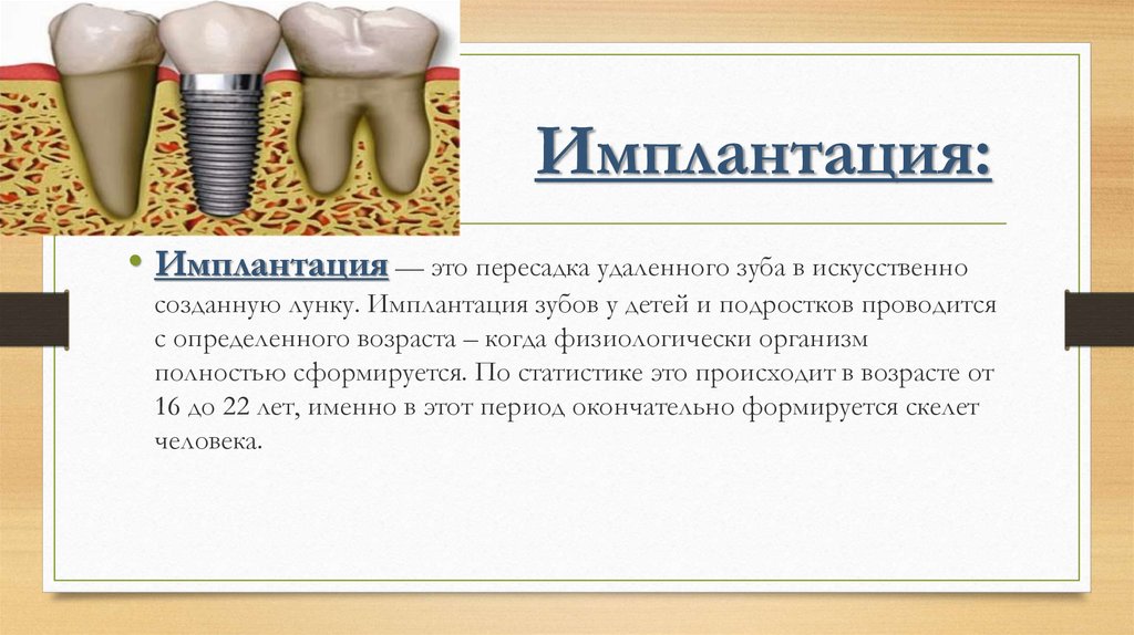 Анатомические предпосылки стоматологической имплантации презентация