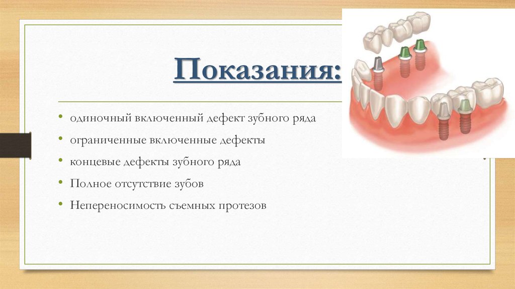 Классификация дефектов зубных рядов