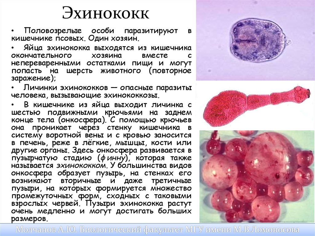 Признаки характерные для эхинококка в живом организме. Эхинококк Финна размер. Половозрелая особь эхинококка. Строение финны эхинококка. Финна эхинококка паразитирует в -.