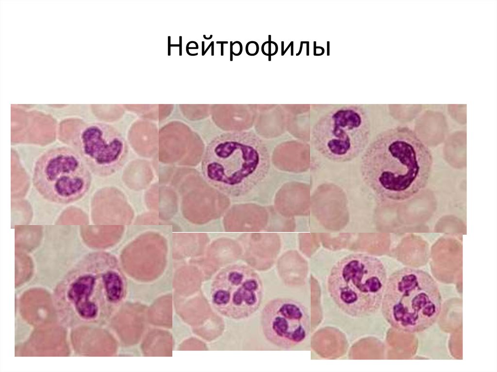 Нейтрофилы это. Палочкоядерные нейтрофилы гистология. Палочкоядерные нейтрофилы препарат. Сегментоядерные нейтрофильные гранулоциты. Сегментоядерные нейтрофилы микроскопия.