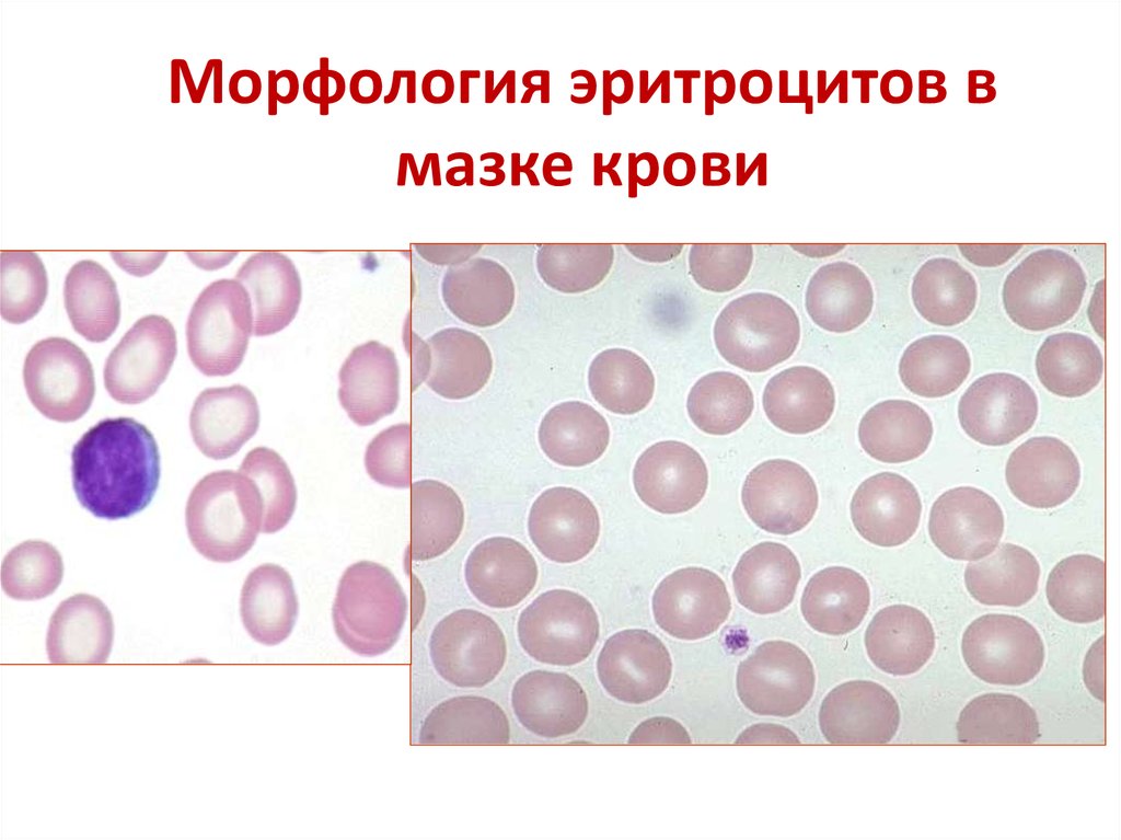 Эритроциты в мазке