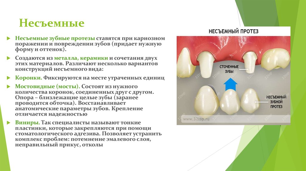 Какую функцию выполняет коронка зуба. Классификация видов несъемных протезов. Классификация несъемных протезов ортопедическая стоматология. Классификация съемных протезов. Классификация протезов в ортопедической стоматологии.