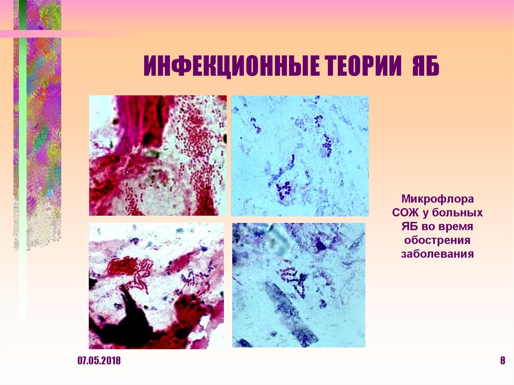 ИНФЕКЦИОННЫЕ ТЕОРИИ ЯБ