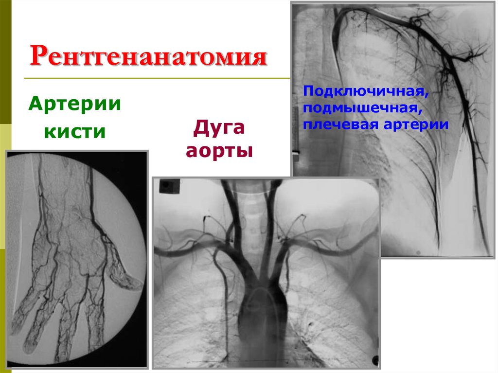 Рентгенанатомия