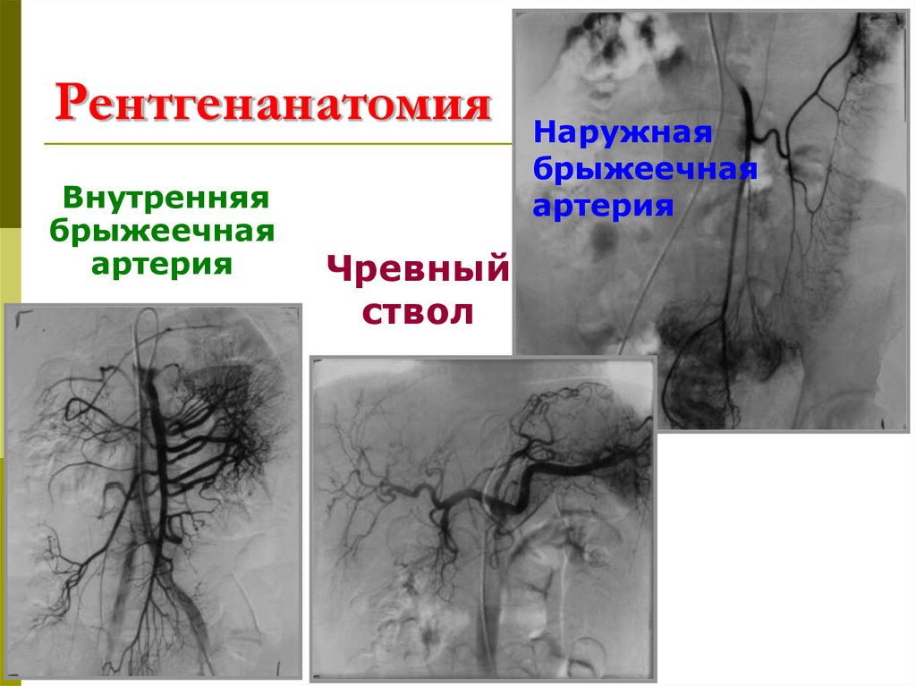 Рентгенанатомия