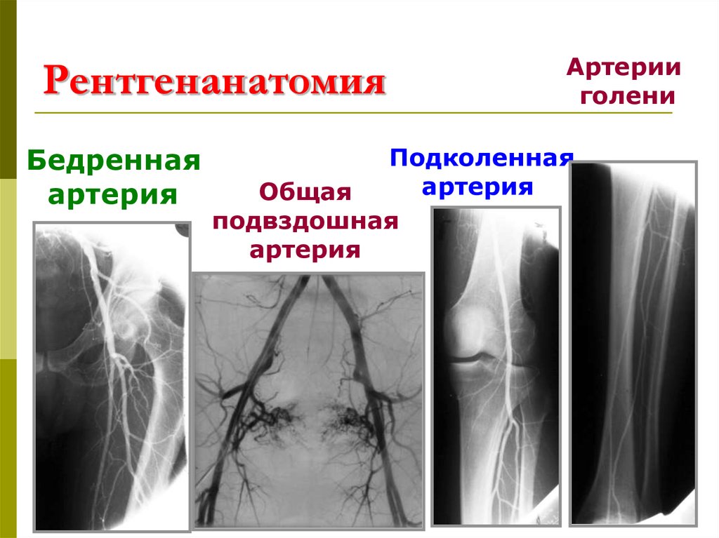Рентгенанатомия
