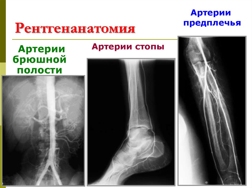 Рентгенанатомия