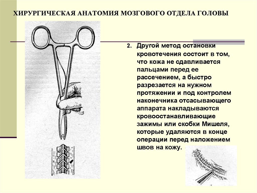 Хирургическая анатомия. Хирургическая анатомия мозгового отдела головы. Шов мягких тканей мозгового отдела головы. Хирургическая анатомия, их содержание..