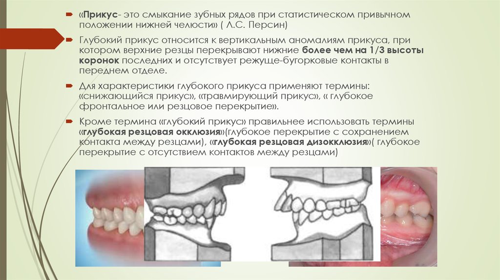 Виды прикусов презентация