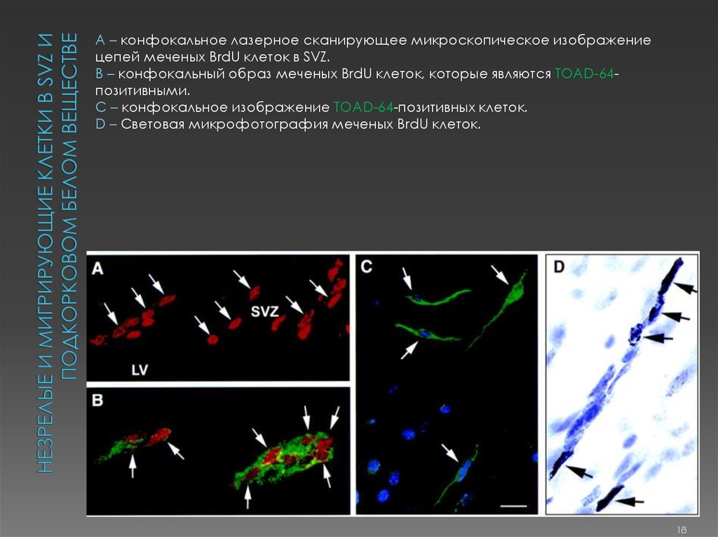 Незрелые и мигрирующие клетки в svz и подкорковом белом веществе
