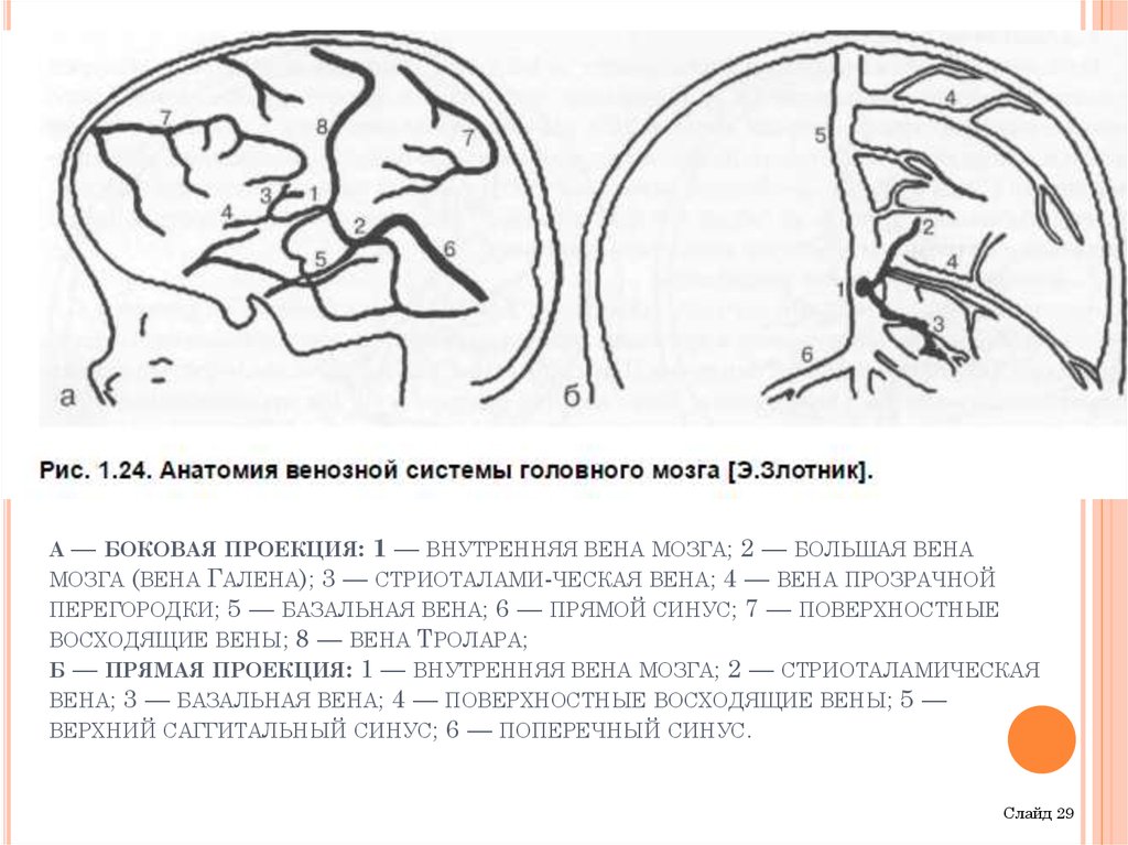 Вена галена у новорожденных