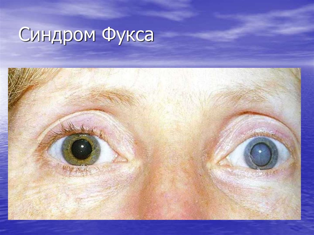 Патология сосудистого тракта - презентация онлайн