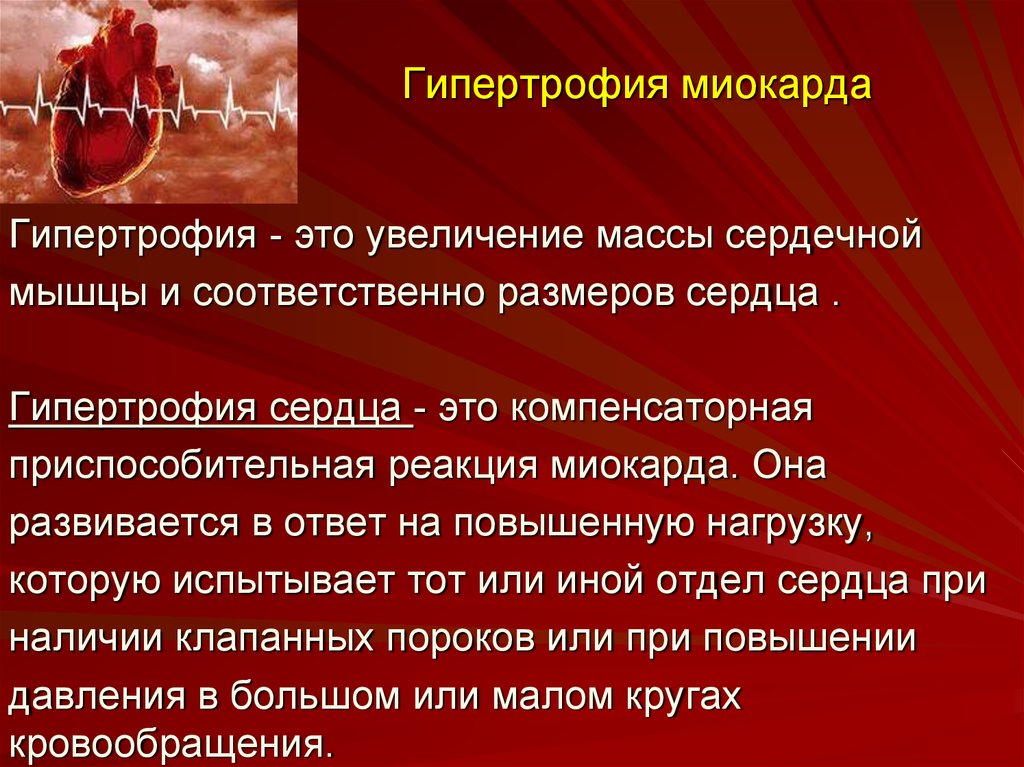 Увеличение сердечной. Гипертрофия мышцы сердца. Гипертрофия миокарда исход. Гипертрофия сердечной мышцы миокарда.