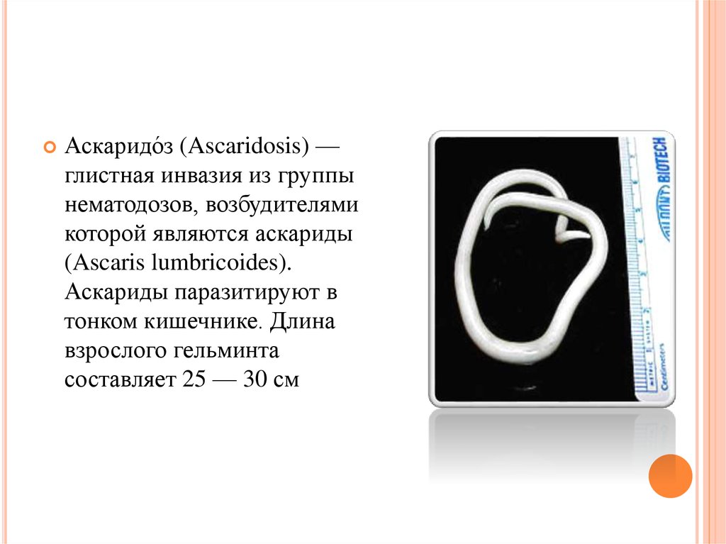 Аскаридоз ответ. Аскаридоз возбудитель. Аскаридоз возбудитель заболевания. Аскаридоз презентация.