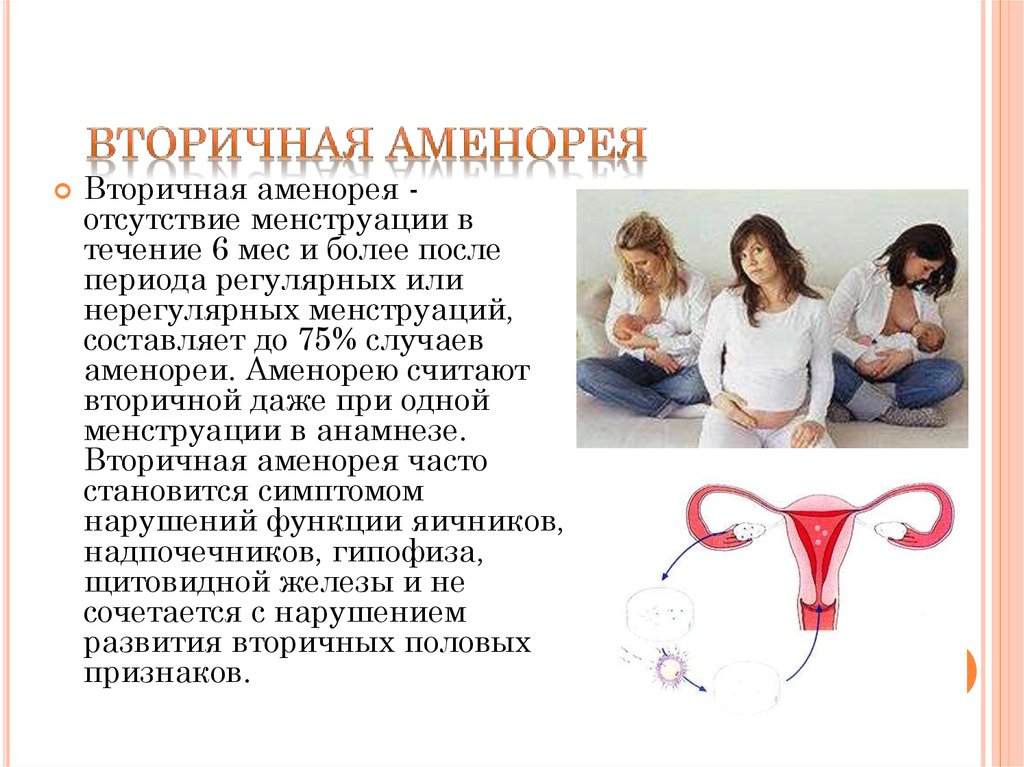 Аменорея симптомы у женщин. Вторичная аменорея. Вторичная маточная аменорея. Маточная аменорея аменорея. Аменапркич.