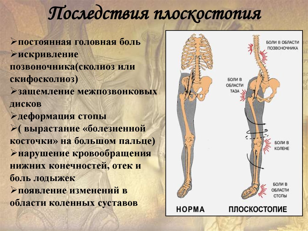 Осанка скелет и мышцы человека презентация 1 класс