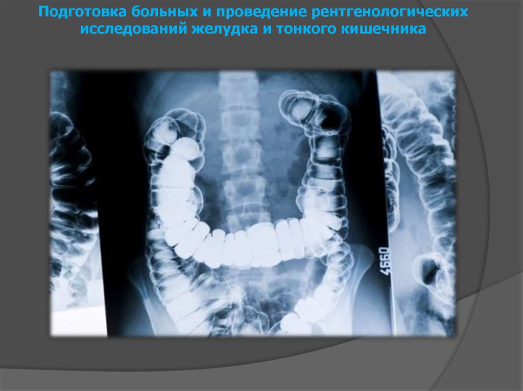 При рентгеноскопии изображение внутренних органов