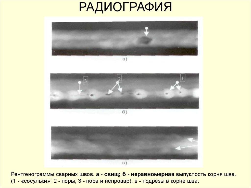 Радиография. Радиографический контроль сварных швов снимки. Рентген сварного шва дефект. Схема компьютерной радиографии сварных соединений. Рентген сварочного шва.