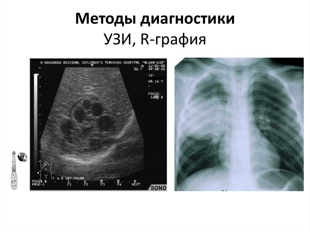 R графия. УЗИ В диагностике хирургической патологии. Офтальмография УЗИ. УЗИ Р-динамика.