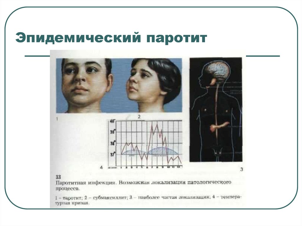 Эпидемический паротит. Эпидемический паротит локализация. Эпидемический паротит синдромы. Эпид паротит пути передачи.