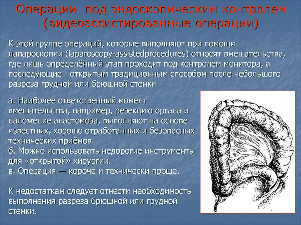 Операции под. Видеоассистированная операция. Видеоассистированная тиреоидэктомия. Видеоассистированная операция определение. Видеоассистированные операции в хирургии.