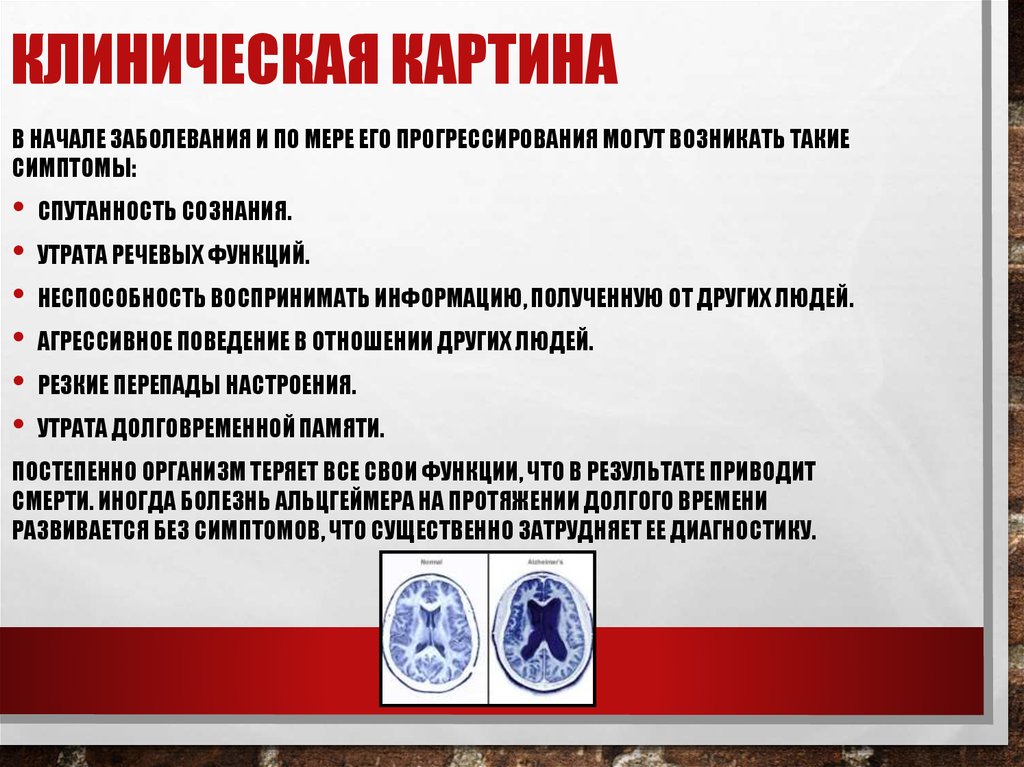 Клиническая картина