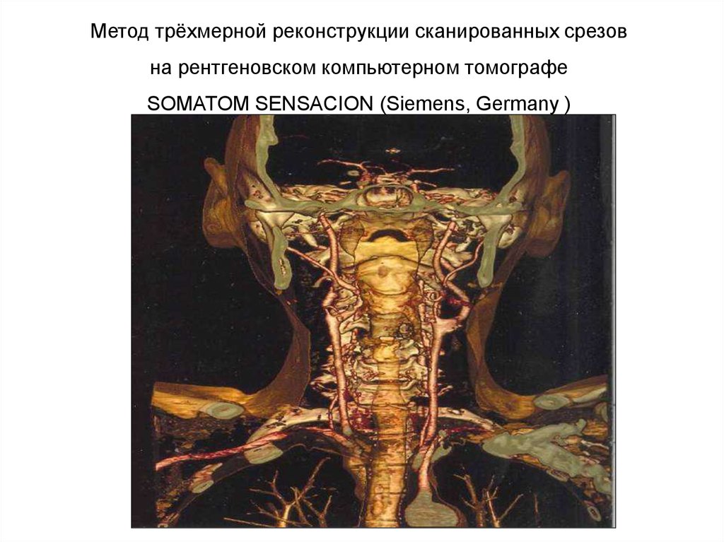 Гаряев матрица кости мышцы суставы. Рентген трёхмерная реконструкция. Атлас рентгеноанатомии. Срезы рентгенографические. Атлас рентгеноанатомии человека.