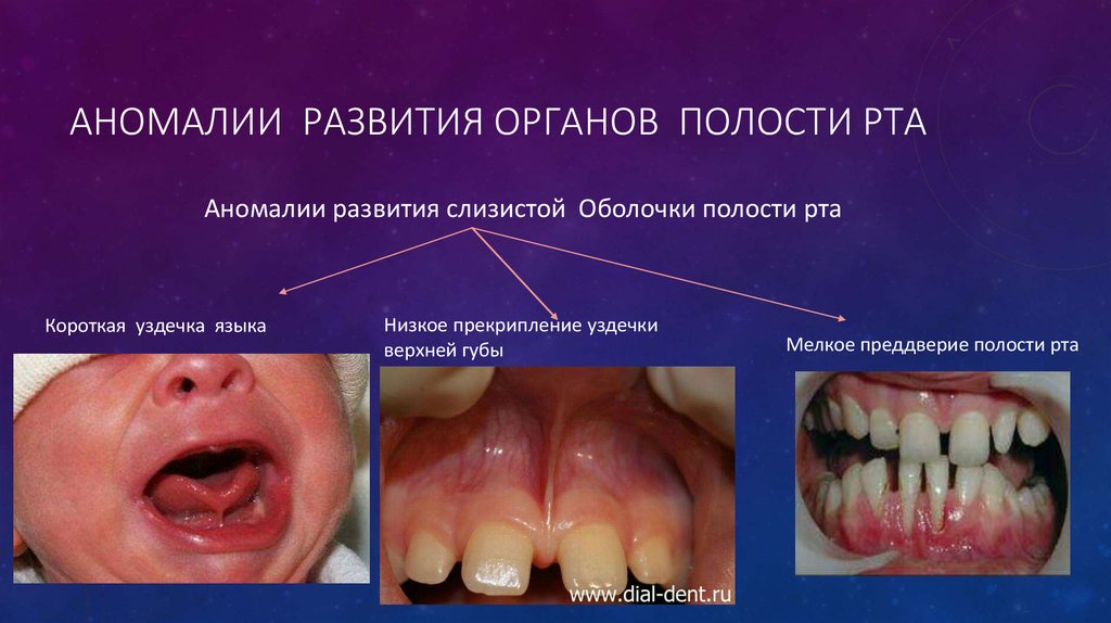 Фото аномалии развития женских половых органов