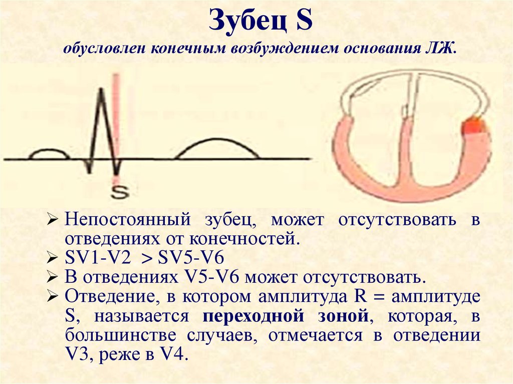 Экг презентация