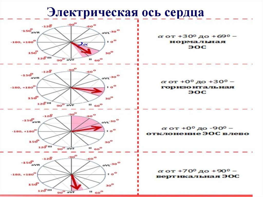 Электрическая ось сердца. Электрическая ось сердца у детей. Нормальная электрическая ось сердца. 8. Электрическая ось сердца.