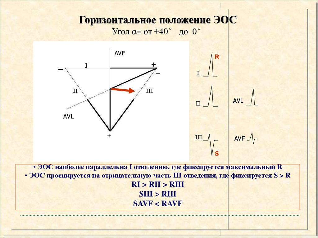 Горизонтальное положение электрической оси сердца