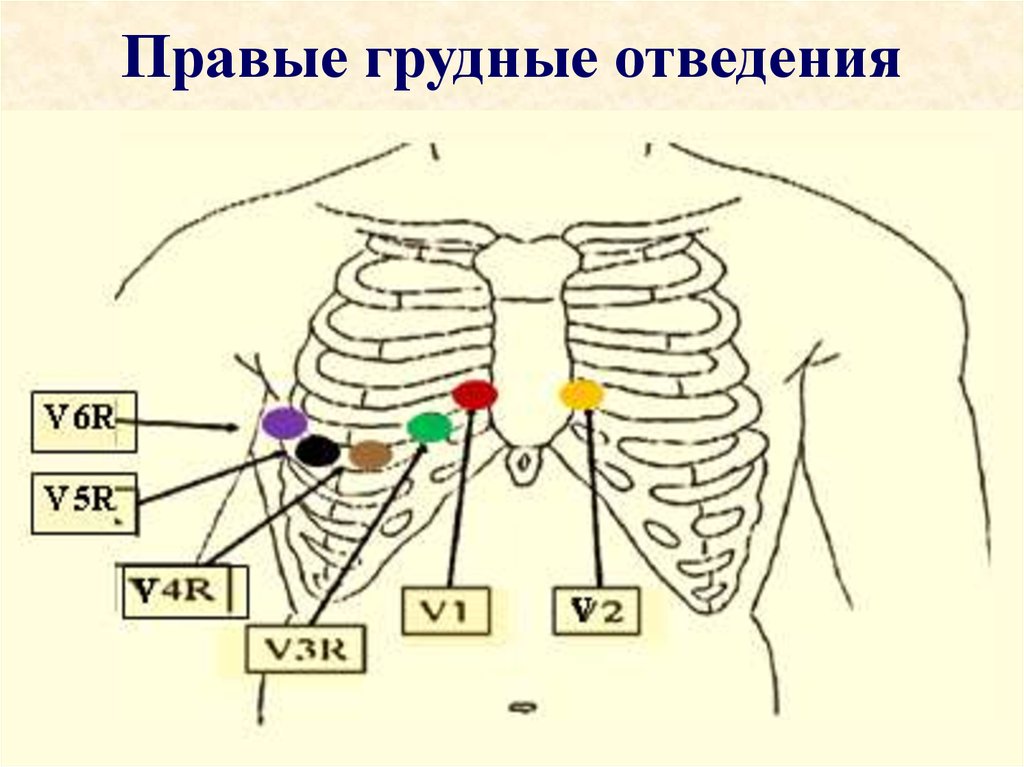 Снятие экг отведения