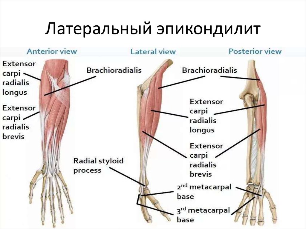 Латеральный эпикондилит. Латеральный надмыщелок локтевого сустава. Латеральный эпикондилит анатомия. Мышцы латеральный надмыщелок.