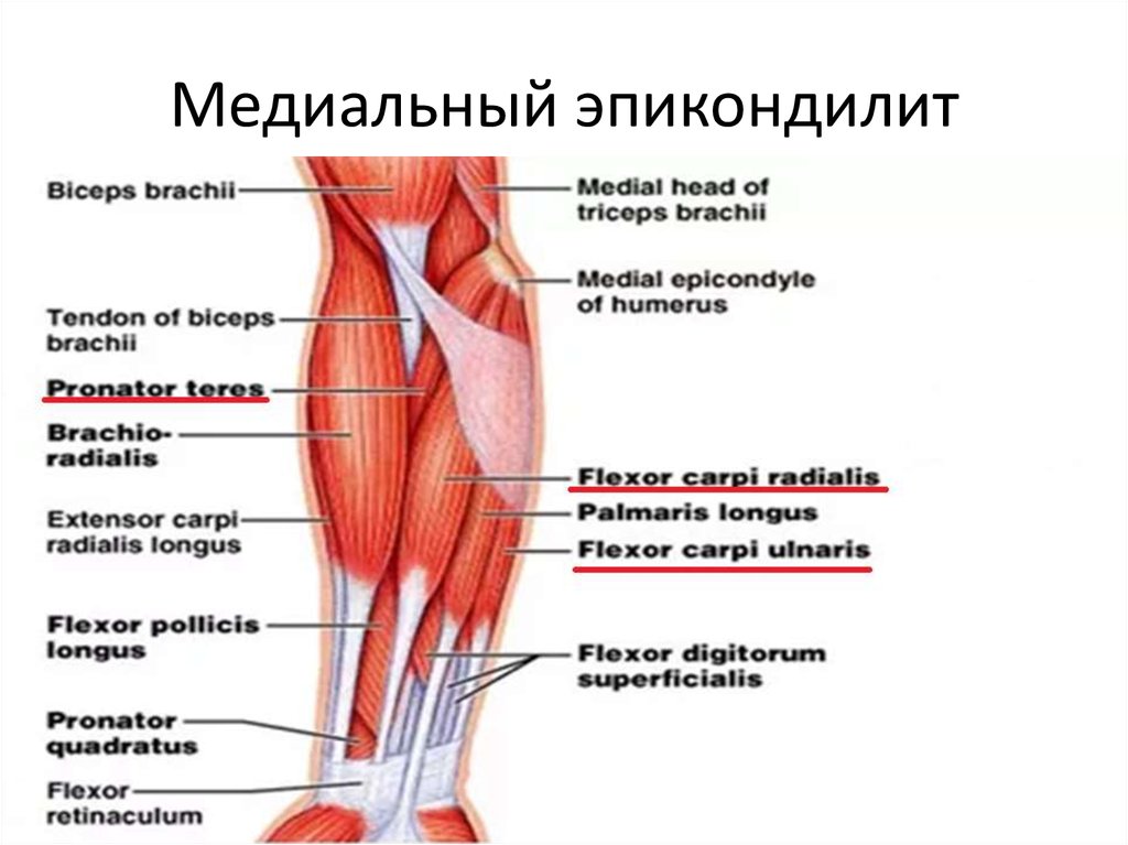 Медиальному надмыщелку кости