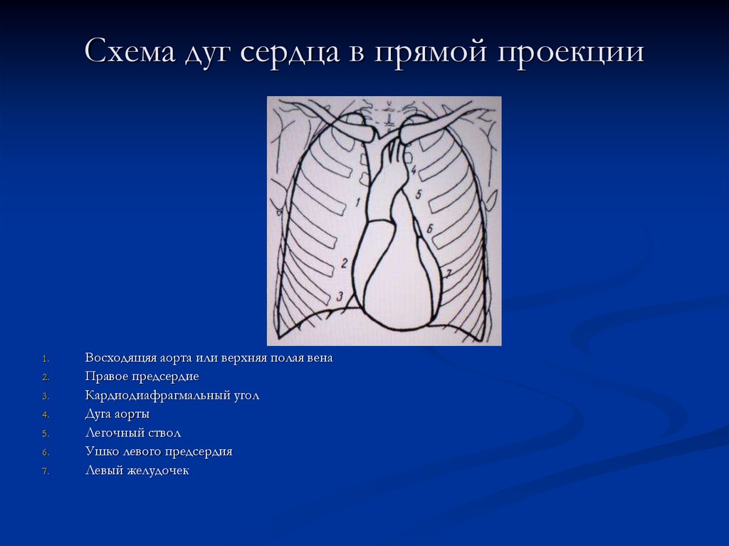 Проекция дуги. Сердце в прямой проекции. Рентген сердца в прямой проекции. Дуги сердца на рентгенограмме. Контуры сердца на рентгенограмме.