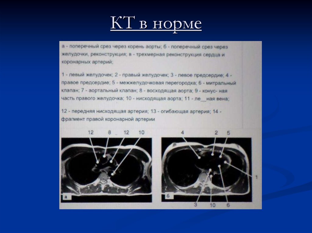 Корень аорты норма. Z критерии корня аорты.