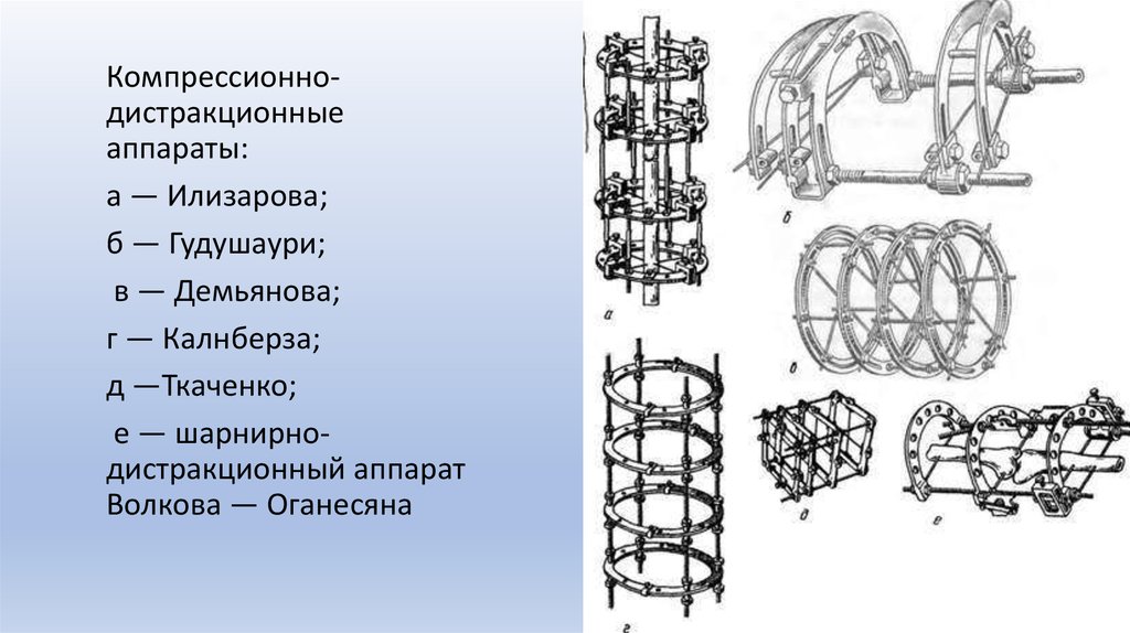 Внеочаговый остеосинтез презентация